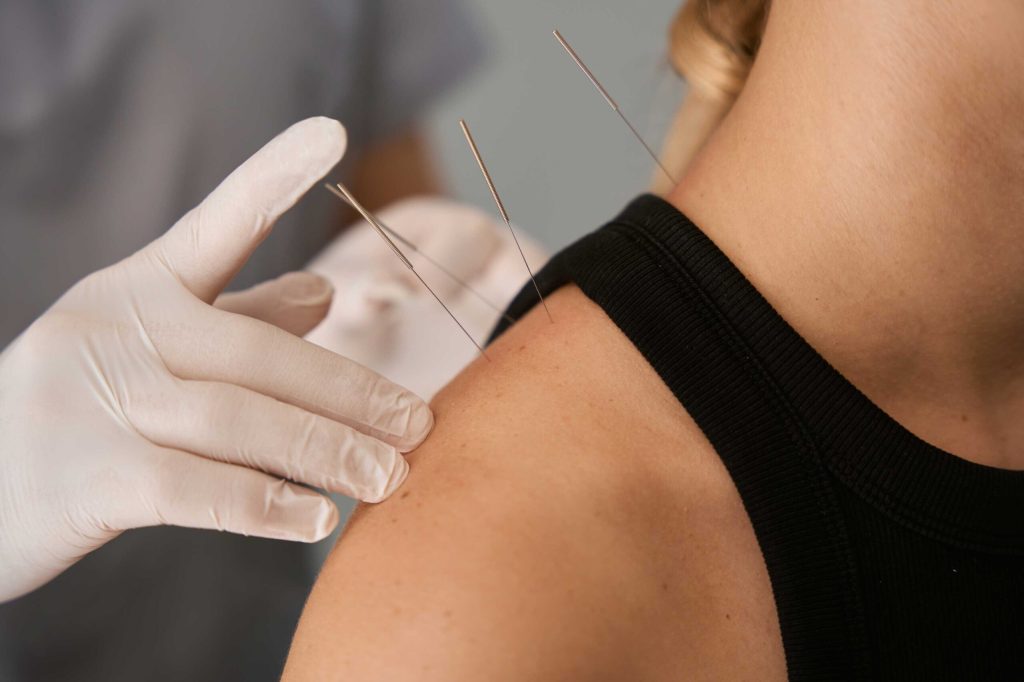Loyalist Acupuncture Advanced Diploma Belleville scaled 1